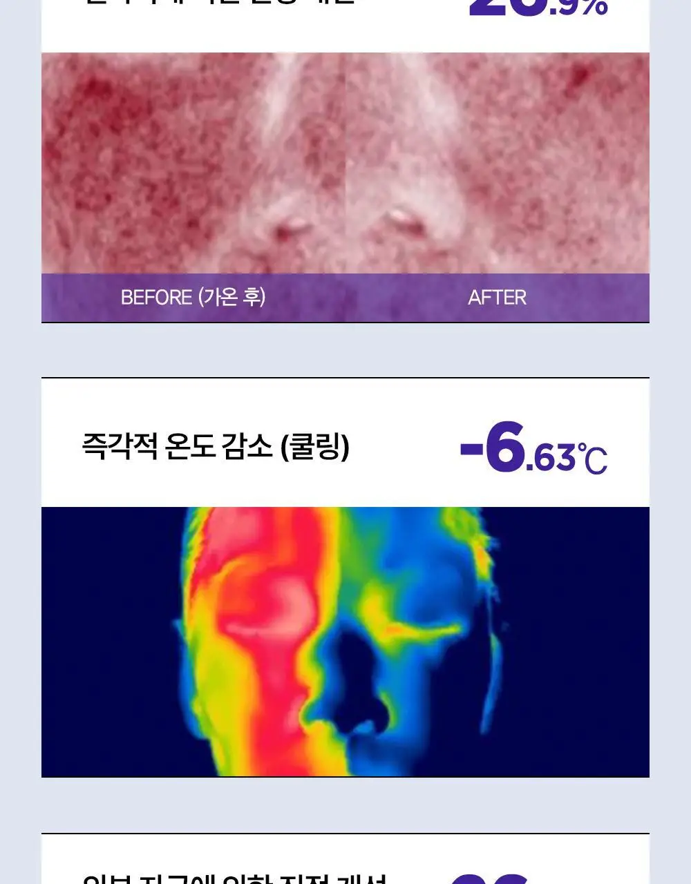 [수분/진정] 더마토리 모델링 팩 단품 2종 택1(시카/히알샷) 상세페이지 12